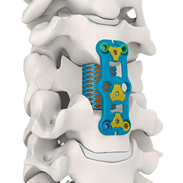 Piastra di colonna vertebrale cervicale anteriore ⅳ